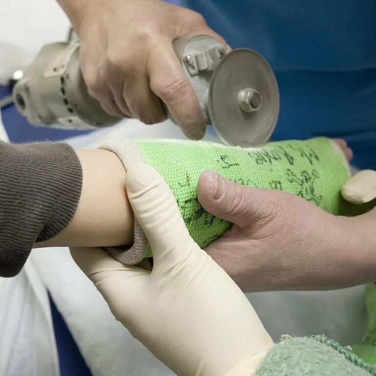 Plaster Cutting Saw AMIS Orthopedic