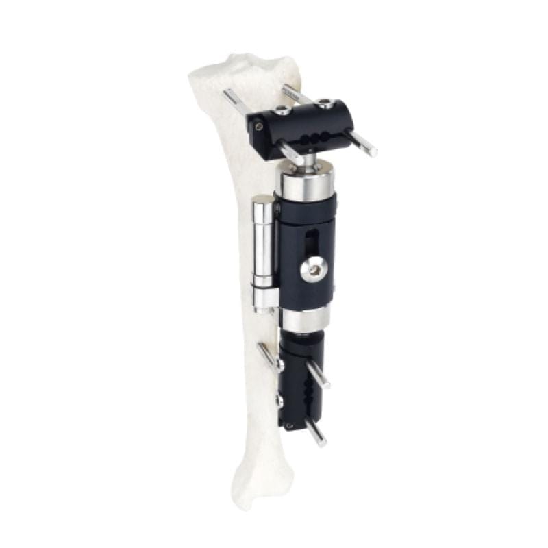 Dynamic Axial Fixator T-Type G08 1 Dynamic Axial Fixator T-Type G08