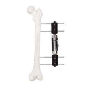 Straight Type Dynamic Axial Fixator G09