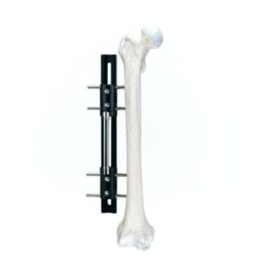 LRS B Bone Lengthening Fixator G1320-B | Pediatric & Adult