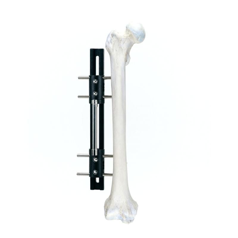 LRS B Bone Lengthening Fixator G1320-B 1 LRS B Bone Lengthening Fixator G1320-B | Pediatric & Adult