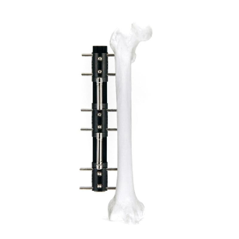 LRS A Bone Lengthening Fixator G1310-A 1 LRS A Bone Lengthening Fixator G1310-A