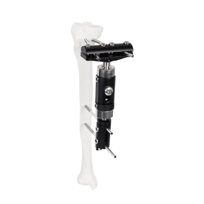 G14 Large T-Type Dynamic Axial Fixator 1 G14 Large T-Type Dynamic Axial Fixator