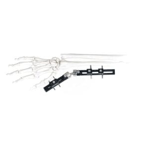 Single Pin Wrist External Fixator G31