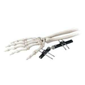 Standard Wrist External Fixator G32